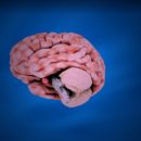 CEREBRAL PALSY