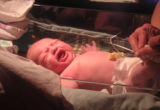 STOMACH AND BOWEL DISORDERS AMONG INFANTS