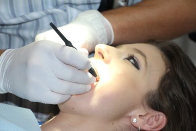 la dental implant