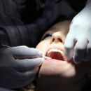 los angeles veneer dentist