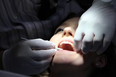 los angeles veneer dentist