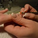 NAILS IN HEALTH AND DISEASE