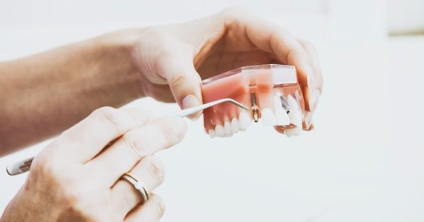 cosmetic dentist torrance
