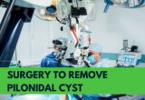 surgery to remove pilonidal cyst