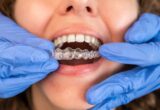 invisalign West Hollywood