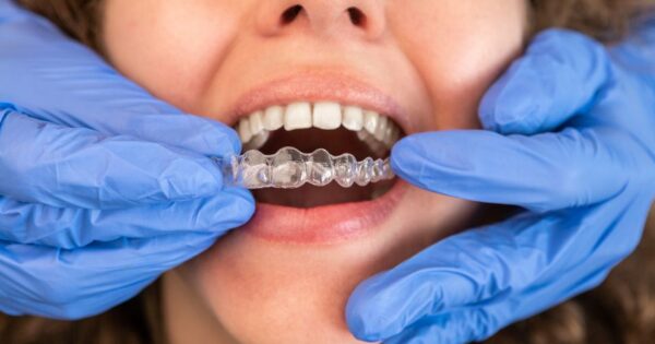 invisalign West Hollywood