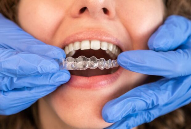 invisalign West Hollywood