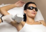 Laser Hair Removal