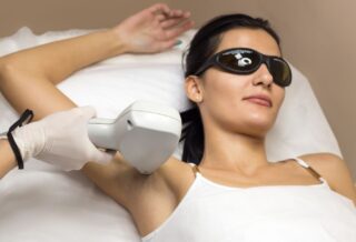 Laser Hair Removal
