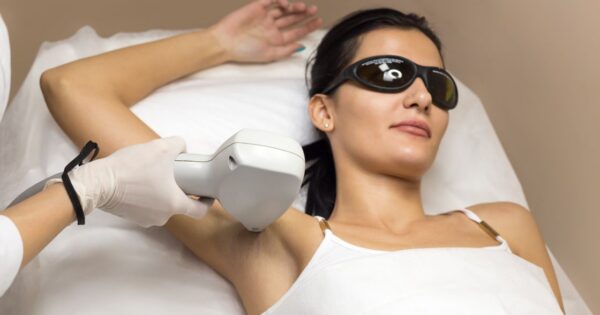 Laser Hair Removal