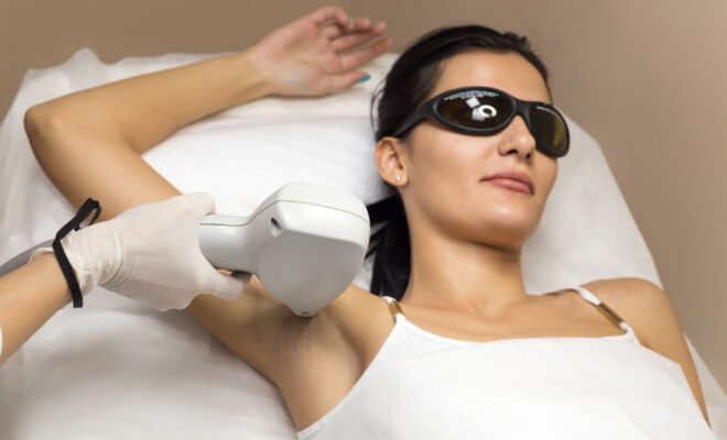 Laser Hair Removal