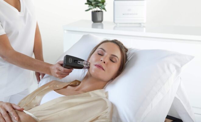 Sofwave Face Treatment for Skin Tightening
