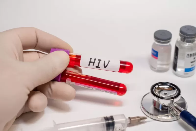 same day testing for std